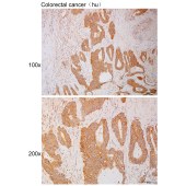 Solarbio K111128P Anti-CDH17 Polyclonal Antibody