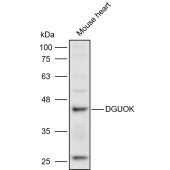 Solarbio K110929P Anti-DGUOK Polyclonal Antibody