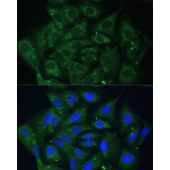 Solarbio K009911P Anti-IGF2BP2 Polyclonal Antibody