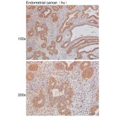 Solarbio K111486P Anti-SMO Polyclonal Antibody