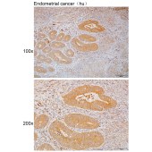 Solarbio K111744P Anti-PLCB1 Polyclonal Antibody