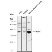 Solarbio K111785P Anti-ASB5 Polyclonal Antibody