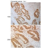 Solarbio K111099P Anti-MAPK8IP2 Polyclonal Antibody