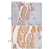 Solarbio K110605P Anti-ERCC6L Polyclonal Antibody