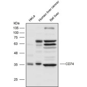 Solarbio K111726P Anti-CD74 Polyclonal Antibody