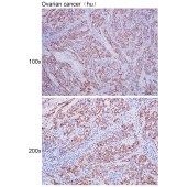 Solarbio K111673P Anti-PMEPA1 Polyclonal Antibody