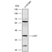 Solarbio K111686P Anti-LAX1 Polyclonal Antibody