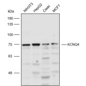 Solarbio K110824P Anti-KCNQ4 Polyclonal Antibody