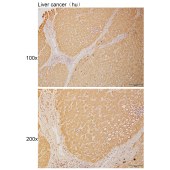 Solarbio K111055P Anti-SLC24A4 Polyclonal Antibody