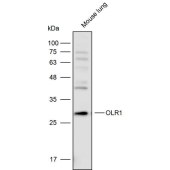 Solarbio K111742P Anti-OLR1 Polyclonal Antibody