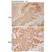 Solarbio K111983P Anti-CEP97 Polyclonal Antibody