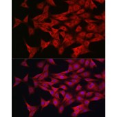 Solarbio K009989P Anti-AMPKa1/AMPKa2 Polyclonal Antibody