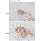 Solarbio K111457P Anti-TCF12 Polyclonal Antibody