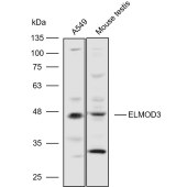 Solarbio K110596P Anti-ELMOD3 Polyclonal Antibody