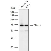Solarbio K111879P Anti-CDH13 Polyclonal Antibody