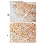 Solarbio K111095P Anti-ATXN1 Polyclonal Antibody