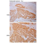 Solarbio K110566P Anti-S100A16 Polyclonal Antibody