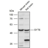 Solarbio K111025P Anti-SYT6 Polyclonal Antibody