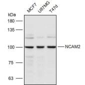 Solarbio K111293P Anti-NCAM2 Polyclonal Antibody