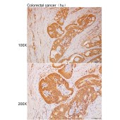 Solarbio K111971P Anti-BABAM2 Polyclonal Antibody