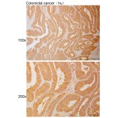 Solarbio K111065P Anti-RAB11FIP4 Polyclonal Antibody