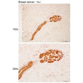 Solarbio K111965P Anti-KRT79 Polyclonal Antibody
