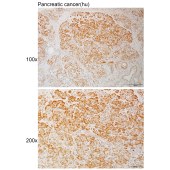 Solarbio K111076P Anti-STAT4 Polyclonal Antibody