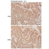 Solarbio K111294P Anti-DDX20 Polyclonal Antibody