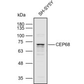 Solarbio K110916P Anti-CEP68 Polyclonal Antibody