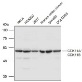 Solarbio K111125P Anti-CDK11A/CDK11B Polyclonal Antibody