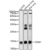 Solarbio K009992P Anti-TGFB1 Polyclonal Antibody