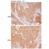 Solarbio K111752P Anti-CA12 Polyclonal Antibody