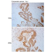 Solarbio K111095P Anti-ATXN1 Polyclonal Antibody