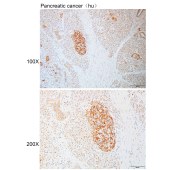 Solarbio K110925P Anti-CLCN7 Polyclonal Antibody