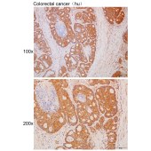 Solarbio K111720P Anti-FBXO42 Polyclonal Antibody