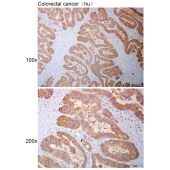Solarbio K110903P Anti-APLP2 Polyclonal Antibody