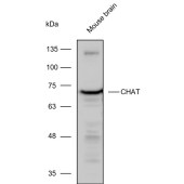 Solarbio K111073P Anti-CHAT Polyclonal Antibody
