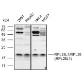 Solarbio K111853P Anti-RPL26L1/RPL26(RPL26L1) Polyclonal Antibody