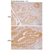 Solarbio K111724P Anti-ABCA3 Polyclonal Antibody