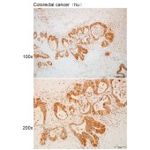 Solarbio K111267P Anti-LPAR1 Polyclonal Antibody