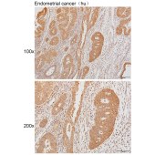 Solarbio K111429P Anti-HLA-DPB1 Polyclonal Antibody