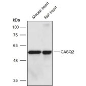 Solarbio K111428P Anti-CASQ2 Polyclonal Antibody