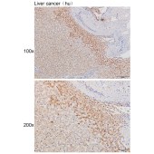 Solarbio K111463P Anti-ANGPTL3 Polyclonal Antibody