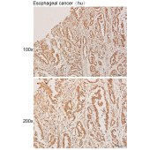 Solarbio K111771P Anti-VCAM1 Polyclonal Antibody