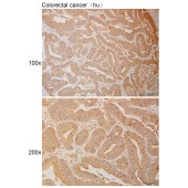 Solarbio K111021P Anti-AMZ2 Polyclonal Antibody