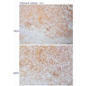 Solarbio K110899P Anti-NOC2L Polyclonal Antibody