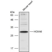Solarbio K111473P Anti-HOXA6 Polyclonal Antibody