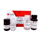 Solarbio G1921 乙型肝炎病毒染色试剂盒(Shikata地衣红法)