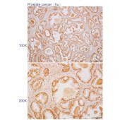 Solarbio K110610P Anti-AP3B1 Polyclonal Antibody