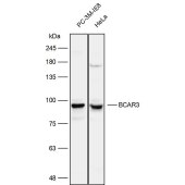 Solarbio K111980P Anti-BCAR3 Polyclonal Antibody